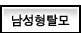 남성형탈모